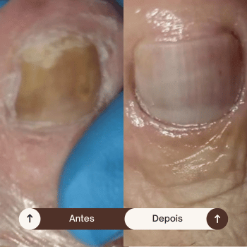 Cópia de Before (25)