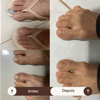 Cópia de Before (26)